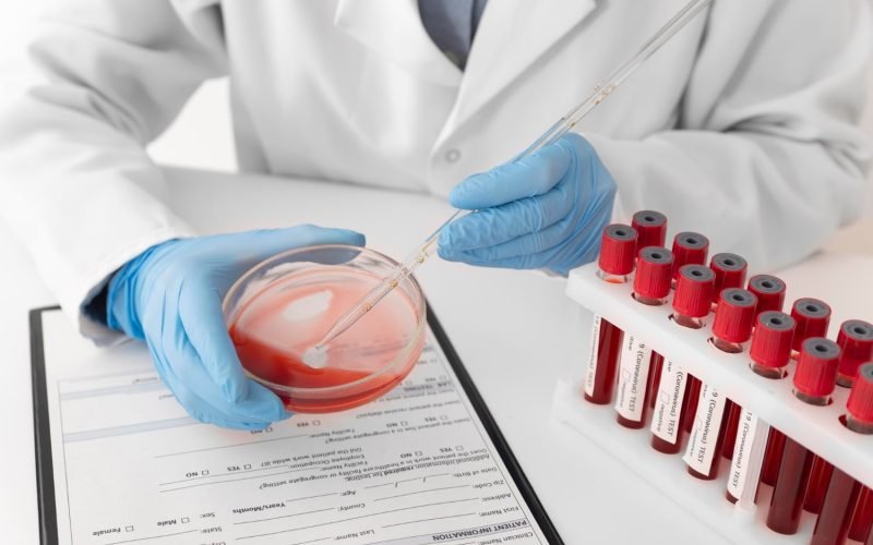 Análisis de Sangre: Qué Pueden Revelar sobre tu Salud